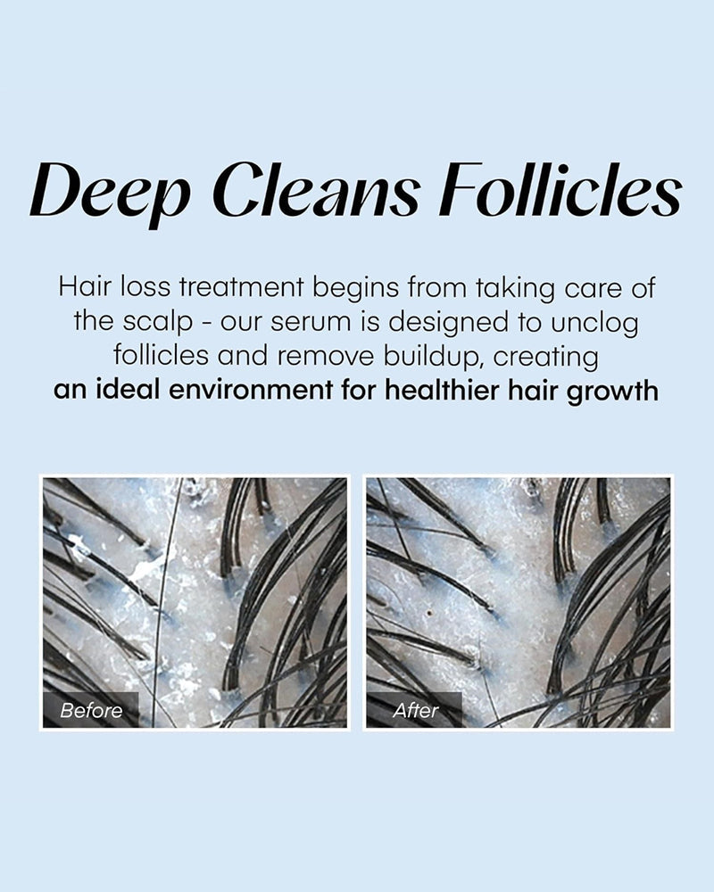 Seapuri Scalpy Hair Serum