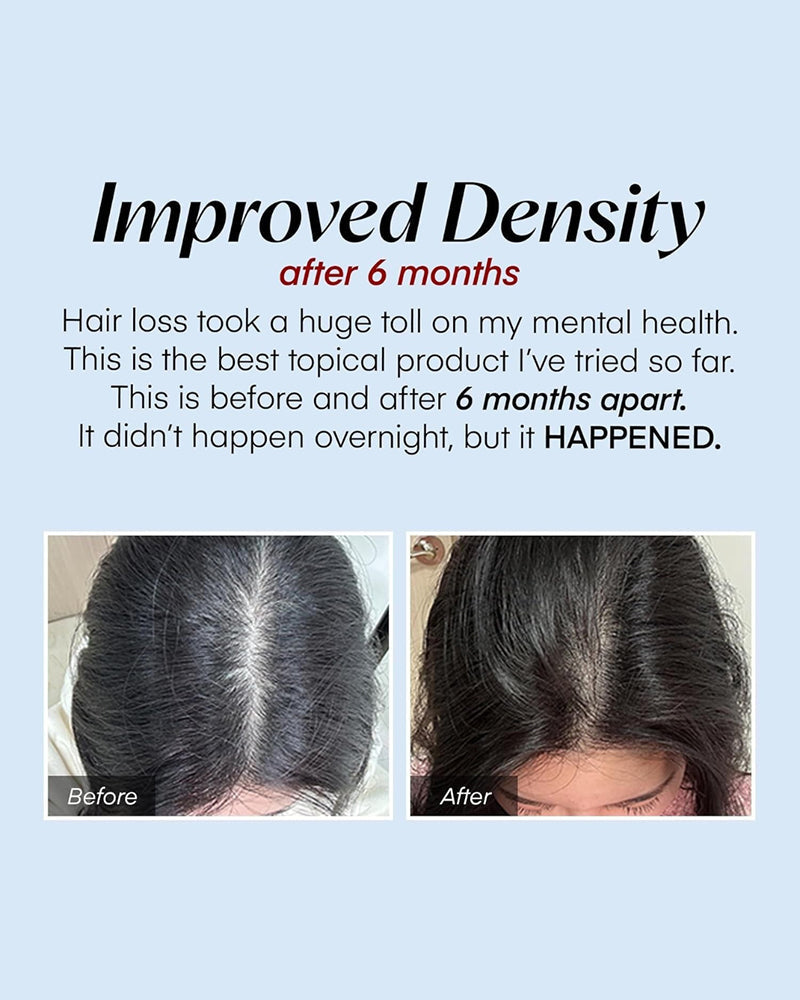 Seapuri Scalpy Hair Serum